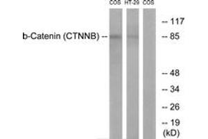 Western blot analysis of extracts from COS7/HT-29 cells, using Catenin-beta (Ab-33) Antibody. (beta Catenin antibody  (AA 17-66))