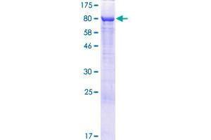 RAI2 Protein (AA 1-530) (GST tag)