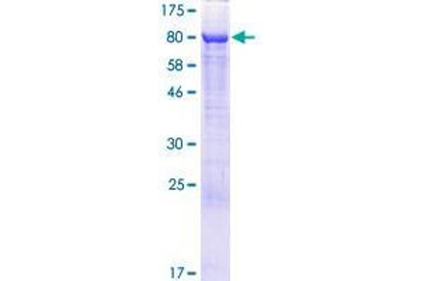 RAI2 Protein (AA 1-530) (GST tag)