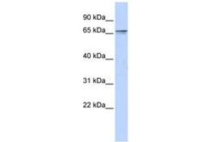 Image no. 1 for anti-Zinc Finger Protein 192 (ZNF192) (C-Term) antibody (ABIN6742803) (ZNF192 antibody  (C-Term))