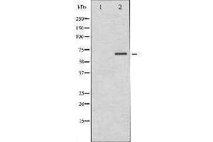 Western blot analysis of PAK1 phosphorylation expression in etoposide treated 293 whole cell lysates,The lane on the left is treated with the antigen-specific peptide.