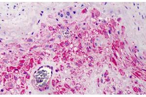 Human Placenta: Formalin-Fixed, Paraffin-Embedded (FFPE) (COPB2 antibody  (AA 494-511))