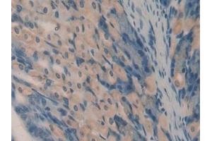 Detection of OCM in Mouse Stomach Tissue using Polyclonal Antibody to Oncomodulin (OCM) (Oncomodulin antibody  (AA 1-109))