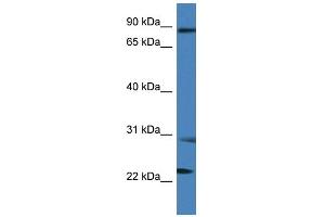 WB Suggested Anti-MIA2 Antibody Titration: 1.