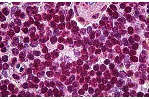 Human Spleen: Formalin-Fixed, Paraffin-Embedded (FFPE) (SOX10 antibody)