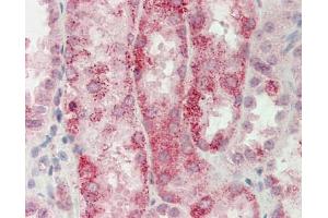 Human Kidney: Formalin-Fixed, Paraffin-Embedded (FFPE). (CDKN3 antibody  (AA 67-116))