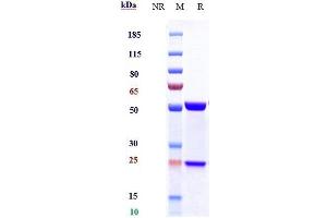 Anti-IL-6 / IFNb2 Reference Antibody (siltuximab) on SDS-PAGE under reducing (R) condition. (Recombinant IL6 (Siltuximab Biosimilar) antibody)