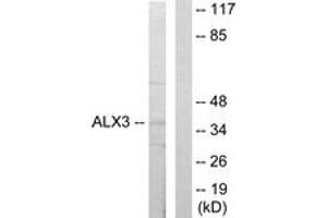 Western blot analysis of extracts from 293 cells, using ALX3 Antibody. (ALX3 antibody  (AA 171-220))