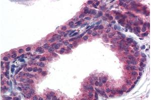 Immunohistochemistry (IHC) image for anti-V-Akt Murine Thymoma Viral Oncogene Homolog 3 (Protein Kinase B, Gamma) (AKT3) (AA 119-133) antibody (ABIN185314)