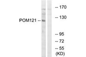 Western blot analysis of extracts from K562 cells, using POM121 Antibody.