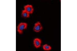 Immunofluorescence (IF) image for anti-Mucin 1 (MUC1) (C-Term) antibody (ABIN7303444)