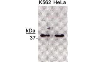 Image no. 2 for anti-Nth Endonuclease III-Like 1 (NTHL1) antibody (ABIN363381) (Nth Endonuclease III-Like 1 (NTHL1) antibody)