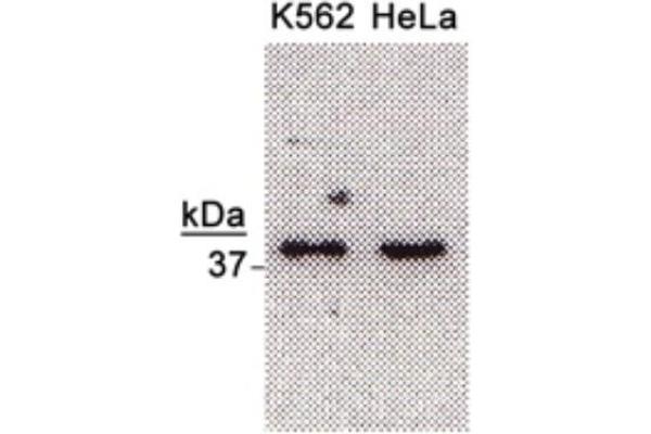 Nth Endonuclease III-Like 1 (NTHL1) antibody