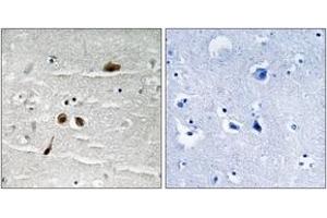 Immunohistochemistry analysis of paraffin-embedded human brain, using MDC1 (Phospho-Ser513) Antibody. (MDC1 antibody  (pSer513))