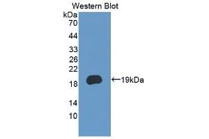 Detection of Recombinant PCDH20, Human using Polyclonal Antibody to Protocadherin 20 (PCDH20) (PCDH20 antibody  (AA 64-209))