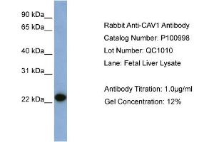 WB Suggested Anti-CAV1  Antibody Titration: 0. (Caveolin-1 antibody  (N-Term))