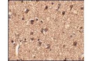 Immunohistochemistry of Slitrk1 in human brain tissue with this product at 2. (SLITRK1 antibody  (Middle Region))
