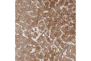 Immunohistochemical staining of human liver with KIF26B polyclonal antibody  shows strong cytoplasmic positivity, with a granular pattern in hepatocytes at 1:50-1:200 dilution. (KIF26B antibody)