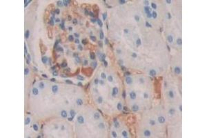 Used in DAB staining on fromalin fixed paraffin- embedded kidney tissue (Uroplakin 3A antibody  (AA 15-212))