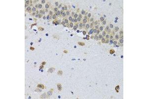 Immunohistochemistry of paraffin-embedded mouse brain using CIRBP antibody. (CIRBP antibody  (AA 1-172))