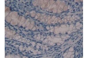 Detection of HDC in Mouse Colon Tissue using Polyclonal Antibody to Histidine Decarboxylase (HDC) (HDC antibody  (AA 341-597))