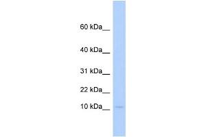 WB Suggested Anti-PLAC9 Antibody Titration:  0. (PLAC9 antibody  (Middle Region))