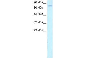 WB Suggested Anti-ZFP95 Antibody Titration: 1. (ZKSCAN5 antibody  (N-Term))