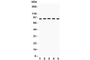 Western blot testing of Glucocorticoid receptor antibody and Lane 1:  HeLa;  2: MCF-7;  3: COLO320;  4: MM231;  5: HEPG2 lysate.