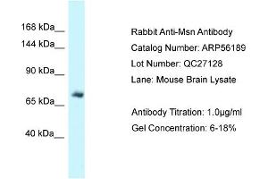 Western Blotting (WB) image for anti-Moesin (MSN) (C-Term) antibody (ABIN2774135) (Moesin antibody  (C-Term))