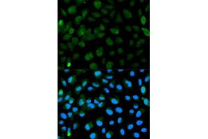 Immunofluorescence analysis of HeLa cell using PML antibody. (PML antibody  (AA 300-600))