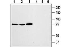 Western blot analysis of rat RBL basophilic leukemia (lanes 1 and 4), human HL-60 promyelocytic leukemia (lanes 2 and 5), and human Jurkat T-cell leukemia (lanes 3 and 6) cell lysates: - 1,2,3. (STIM1 antibody  (Extracellular, N-Term))