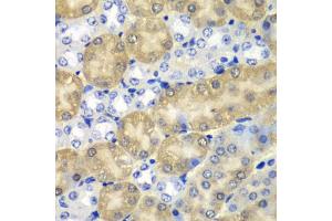 Immunohistochemistry of paraffin-embedded mouse kidney using AMY1A antibody. (AMY1A antibody)