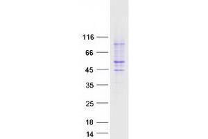 Validation with Western Blot
