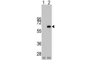 Image no. 1 for anti-Myc Proto-Oncogene protein (MYC) antibody (ABIN357362) (c-MYC antibody)