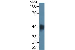 Detection of LPS in Native Lipopolysaccharides using Monoclonal Antibody to Lipopolysaccharide (LPS) (Lipopolysaccharides (LPS) antibody)