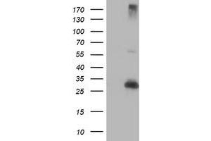Western Blotting (WB) image for anti-Regulatory Factor X-Associated Ankyrin Containing Protein (RFXANK) antibody (ABIN1500679) (RFXANK antibody)