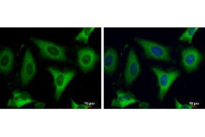 ICC/IF Image Fatty Acid Synthase antibody [N1N2], N-term detects Fatty Acid Synthase protein at cytoplasm by immunofluorescent analysis. (Fatty Acid Synthase antibody  (N-Term))