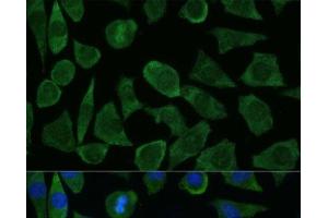 Immunofluorescence analysis of L929 cells using FKBP1B Polyclonal Antibody at dilution of 1:100 (40x lens). (FKBP1B antibody)