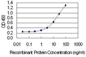 Detection limit for recombinant GST tagged XPA is 0. (XPA antibody  (AA 1-273))