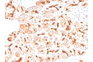 Formalin-fixed, paraffin-embedded human Pancreas stained with CFTR Rabbit Recombinant Monoclonal Antibody (CFTR/2290R). (Recombinant CFTR antibody)