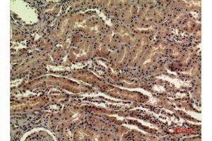 Immunohistochemistry (IHC) analysis of paraffin-embedded Human Kidney, antibody was diluted at 1:100. (SDHB antibody  (Internal Region))