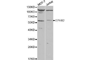 Western blot analysis of extracts of various cell lines, using EPXH2 antibody. (EPHX2 antibody)