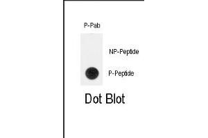 Dot blot analysis of anti-Phospho-TERT-p Antibody (ABIN390002 and ABIN2839778) on nitrocellulose membrane. (TERT antibody  (pTyr707))