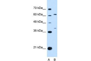 WB Suggested Anti-IL28RA Antibody Titration:  0. (IL28RA antibody  (N-Term))