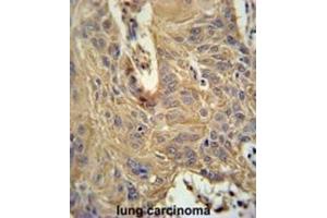 Immunohistochemistry (IHC) image for anti-Interleukin 5 Receptor, alpha (IL5RA) antibody (ABIN3002275) (IL5RA antibody)