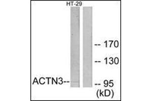 Western blot analysis of extracts from HT-29 cells, using ACTN3 Antibody.
