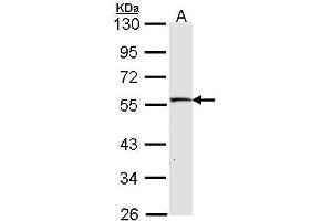 WB Image Sample (30 ug of whole cell lysate) A: IMR32 10% SDS PAGE antibody diluted at 1:1000 (STK26/MST4 antibody  (C-Term))