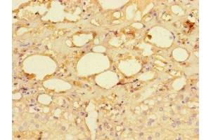 Immunohistochemistry of paraffin-embedded human adrenal gland tissue using ABIN7142262 at dilution of 1:100 (MRPS28 antibody  (AA 72-187))