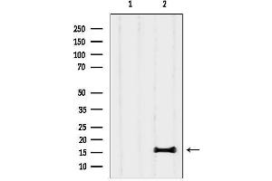 anti-Phospholipase A2, Group IB (PLA2G1B) (C-Term) antibody