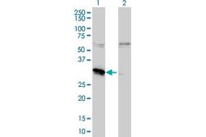 Western Blot analysis of MLF2 expression in transfected 293T cell line by MLF2 monoclonal antibody (M01), clone 2F6-1E3. (MLF2 antibody  (AA 1-248))